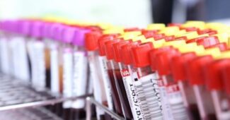 rggc test za zgodnje odkrivanje raka