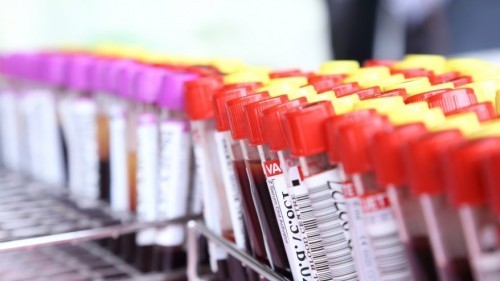 rggc test za zgodnje odkrivanje raka