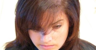 prezgodnje izpadanje las