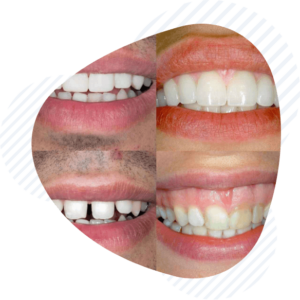 estetsko zobozdravstvo