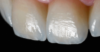 estetsko zobozdravstvo in implantologija Sekulic