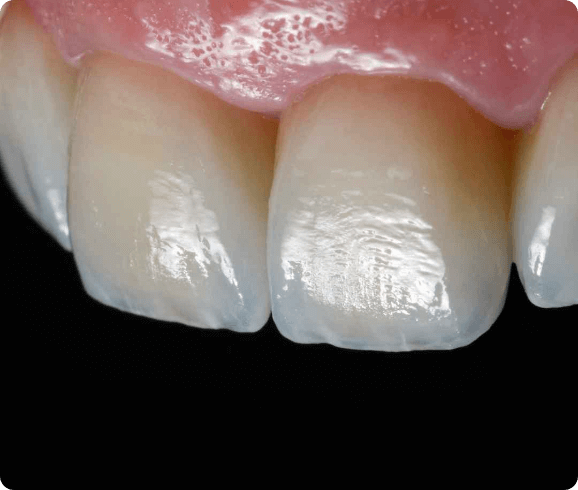 estetsko zobozdravstvo in implantologija Sekulic